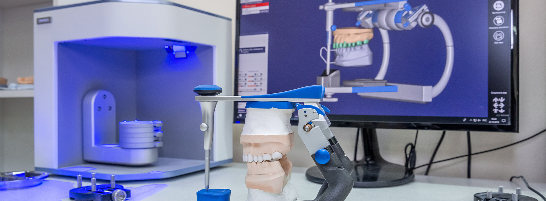 Isbell Dental | 3-D Printer, Veneers and Invisalign reg 