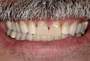 Isbell Dental | Teeth Whitening, Periodontal Treatment and Night Guards