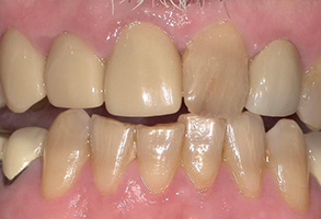 Isbell Dental | Emergency Treatment, Pediatric Dentistry and Preventative Program