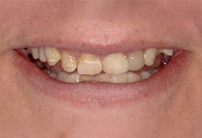 Isbell Dental | Cosmetic Dentistry, Night Guards and Invisalign reg 