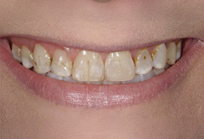 Isbell Dental | Botox reg , Candid and CEREC