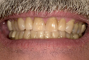 Isbell Dental | Root Canals, CBCT and Candid