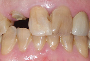 Isbell Dental | Oral Exams, Extractions and Sedation Dentistry