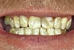 Isbell Dental | Digital Radiography, Teeth Whitening and Pediatric Dentistry